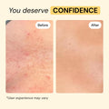 MyMagicHealer Universal Flare Care – Multi-Purpose Solution | Skin Flare-Ups - Hidradenitis Suppurativa, Folliculitis, Boils, Cysts | Anti-Chafing | Irritated Skin Relief w/Propolis & Egg Yolk 28 g 🍁 All In One Marketplace Canada