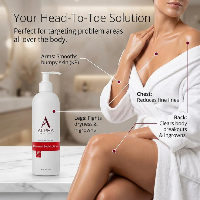 Alpha Skin Care Revitalizing Body Lotion, 12% Glycolic AHA, Daily Moisturizer, Hydrates & Exfoliates, Anti-Aging, 12 Oz 🍁 All In One Marketplace Canada