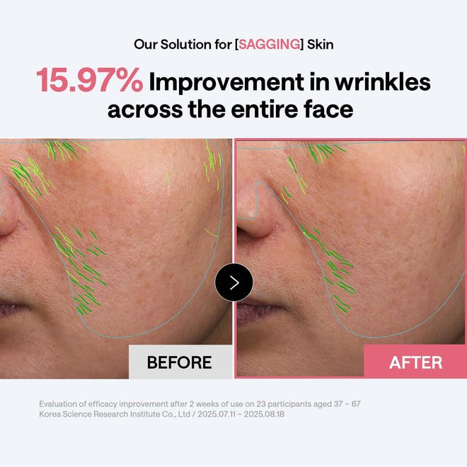 MEDIHEAL Collagen Firming Toner Pad – Korean Skincare, 98% Vegan Collagen with Retinol & 7 Peptides, Firming, Plumping & Wrinkle Care, Micro-Hole Fabric, 100 Pads 🍁 All In One Marketplace Canada
