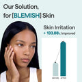 MEDIHEAL Madecassoside Essential Face Mask - Korean Skincare, Blemish Repair with Hyaluronic Acid, Moisture Barrier & Skin Texture Care for Women, Vegan Formula (10 Sheets) 🍁 All In One Marketplace Canada