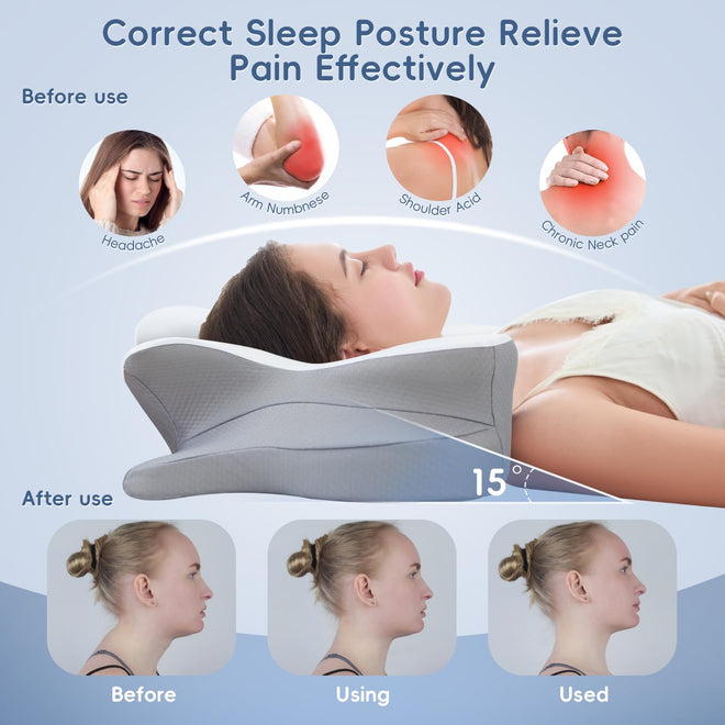 SNUGUP Ergonomic Cervical Neck Pillow, Memory Foam Neck Support Pillow with Contoured Design, Breathable Removable Pillowcase, for Side Back Stomach Sleepers, White 🍁 All In One Marketplace Canada