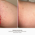 Bushbalm Ingrown Hair and Razor Bumps 2 Step Routine - Moisturize and Soothe - Nude Ingrown Hair Oil (30 ml), Nude Exfoliating Scrub (236 ml) - Nude - Valued at $49 🍁 All In One Marketplace Canada