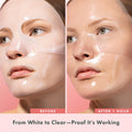 Rael Collagen PDRN Hydrogel Mask - Deep Hydration, Daily Face Masks for Face, Korean Skincare (4 Count) 🍁 All In One Marketplace Canada