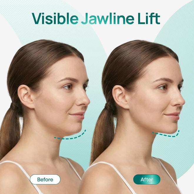 Plantifique V-Line Face Mask with Hyaluronic Acid, 5 Pack Chin Strap for Double Chin, V Line Lifting Masks - V Shape Face Tape, Jawline & Neck Mask for Skin Firming 🍁 All In One Marketplace Canada