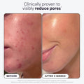 Paula's Choice SKIN PERFECTING 2% BHA Liquid Salicylic Acid Exfoliant Duo, Gentle Exfoliator for Enlarged Pores, Wrinkles & Fine Lines, Includes 1 Full Size Bottle & 1 Travel Size Bottle 🍁 All In One Marketplace Canada