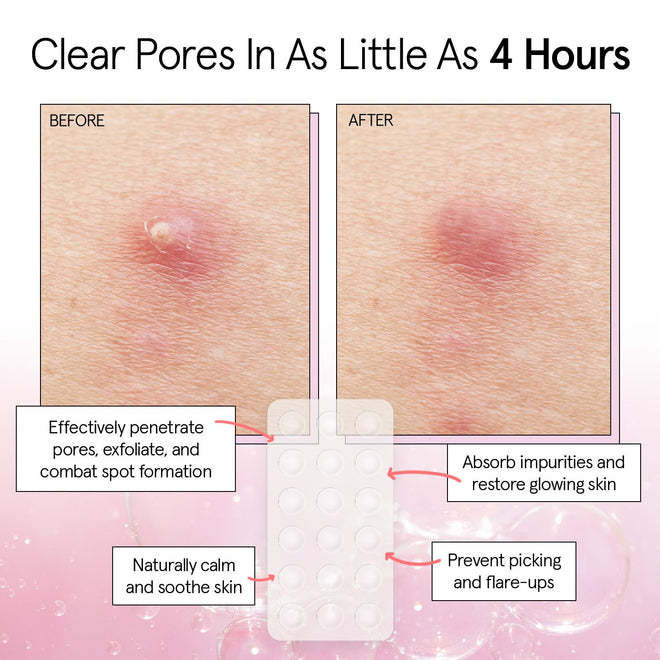 grace & stella Award Winning Invisible Skin Rescue Covers with Hydrocolloid (Round, 36 Count) - With Salicylic Acid and Tea Tree for Absorbing Impurities - Dermatologist Tested Skin Care, Cruelty Free, Vegan 🍁 All In One Marketplace Canada