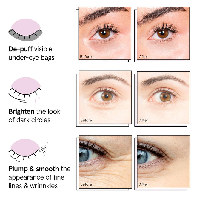 grace & stella Under Eye Patches (12 pairs) Eye Masks for Dark Circles and Puffiness - Birthday Gifts for Women, Bachelorette Party Favors, Bridesmaid Proposal Gifts, Self Care, Spa, Relaxation, Vegan 🍁 All In One Marketplace Canada