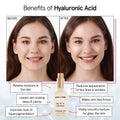 grace & stella Award Winning Hyaluronic Acid Serum for Face (50ml) Hydrating Hyaluronic Acid - Acide Hyaluronique Face - Anti Aging Serum to Hydrate, Remove Fine Lines, Wrinkles, Boost Collagen 🍁 All In One Marketplace Canada