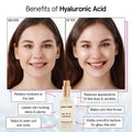 grace & stella Award Winning Hyaluronic Acid Serum for Face (50ml, 2-pack) Hydrating Hyaluronic Acid - Acide Hyaluronique Face - Glass Skin - Anti Aging Serum to Hydrate, Remove Fine Lines, Wrinkles, Skin Texture 🍁 All In One Marketplace Canada