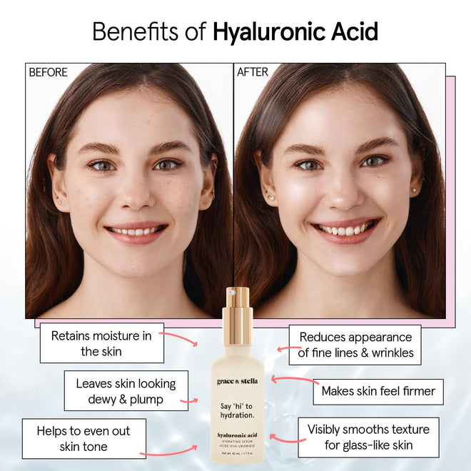 grace & stella Award Winning Hyaluronic Acid Serum for Face (50ml, 2-pack) Hydrating Hyaluronic Acid - Acide Hyaluronique Face - Glass Skin - Anti Aging Serum to Hydrate, Remove Fine Lines, Wrinkles, Skin Texture 🍁 All In One Marketplace Canada