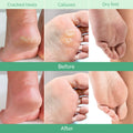 PLANTIFIQUE Foot Peel Mask Dermatologically Tested - 2 Pairs Peach Exfoliating Mask for Dry Cracked Feet - Masque Pied Peeling - Foot Care for Soft Baby Feet 🍁 All In One Marketplace Canada