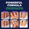 Orivelle Toenail Care Pen - Extra Strength Toe Nail Remedy - Professional Nail Solution for Fingernail with Tea Tree Oil (Pack of 4) 🍁 All In One Marketplace Canada