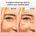 grace & stella Retinol & Caffeine Eye Cream Stick - Under Eye Cream for Dark Circles, Anti-Aging, Puffiness, Wrinkles, Undereye Bags - Brightener with Niacinamide - Vegan Skincare (0.13 oz/3.5 g) 🍁 All In One Marketplace Canada