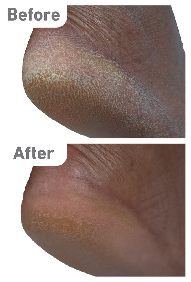 O'Keeffe's Healthy Feet Heel Balm Stick for Dry Cracked Feet & Heels 🍁 All In One Marketplace Canada