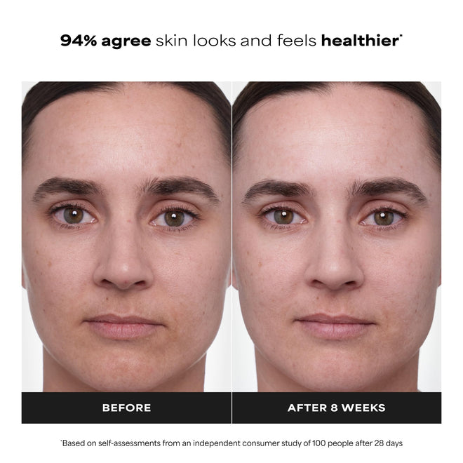 Paula's Choice CLINICAL 1% Retinol Treatment Cream with Peptides, Vitamin C & Licorice Extract, Anti-Aging Treatment for Wrinkles & Loss of Firmness, Fragrance-Free, 30 mL 🍁 All In One Marketplace Canada