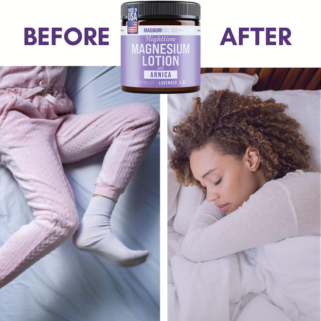 Nighttime Magnesium Lotion with Arnica – Highly Concentrated Magnesium for Muscles & Joints – Apply to Legs or Feet Before Bed – Skin-Friendly 🍁 All In One Marketplace Canada