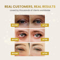 PLANTIFIQUE 24K Gold Under Eye Patches - Dermatologist Tested - 20 Pairs Cooling Eye Masks for Dark Circles & Puffiness, with Collagen & Hyaluronic Acid - Patch Yeux 🍁 All In One Marketplace Canada