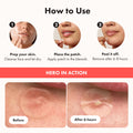 Hero Cosmetics Mighty Patch Original – Hydrocolloid Patch for Pimples, Overnight Acne Blemish & Zit Stickers for Sensitive Skin, 36 Count 🍁 All In One Marketplace Canada