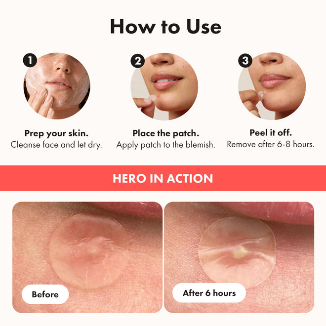 Hero Cosmetics Mighty Patch Original – Hydrocolloid Patch for Pimples, Overnight Acne Blemish & Zit Stickers for Sensitive Skin, 36 Count 🍁 All In One Marketplace Canada