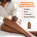 Palmer's Cocoa Butter Formula Vitamin E Scar Serum, 30ml 🍁 All In One Marketplace Canada