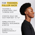 Nioxin System 1 Scalp + Hair Thickening Shampoo | For Natural Hair with Light Thinning | Strengthen Against Breakage with Niacinamide & Biotin | 33.8 Fl Oz 🍁 All In One Marketplace Canada