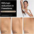 Braun Silk-Expert Pro 5 IPL PL5157 at Home Laser Hair Removal for Women and Men with Premium Pouch, Venus Razor, 2 Heads 🍁 All In One Marketplace Canada