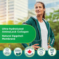 Genacol Pain Relief (60-Day Supply) – Natural Eggshell Membrane and Ultra-Hydrolyzed Collagen Peptides, Joint Pain Relief Supplement, Results in Just 5 Days, Value Pack, 180 Capsules 🍁 All In One Marketplace Canada