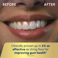 Waterpik Aquarius Water Flosser For Teeth Cleaning, Gums, Braces, Dental Care, Electric Power With 10 Settings, 7 Tips For Multiple Users & Needs, CDA Validated, Blue WP-663, Packaging May Vary 🍁 All In One Marketplace Canada
