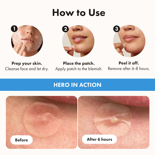 Hero Cosmetics Mighty Patch Invisible+ – Barely-there Hydrocolloid Patch for Pimples on the Face, Day-time Patches for Sensitive Skin, 39 Count 🍁 All In One Marketplace Canada