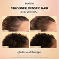 Pantene Abundant & Strong Daily Scalp Serum, Strengthens Scalp’s Hold on Roots, 60 ml 🍁 All In One Marketplace Canada