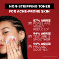 Thayers Alcohol-Free 2% Salicylic Acid Toner with Witch Hazel, Lemongrass and Aloe Vera for Acne-prone Skin, 355 ml 🍁 All In One Marketplace Canada