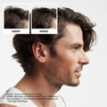 Nioxin Scalp + Hair Thickening System 2 Shampoo, For Natural Hair with Progressed Thinning, 33.8 fl oz (Packaging May Vary) 🍁 All In One Marketplace Canada