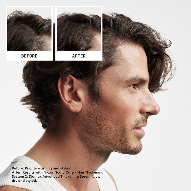 Nioxin Scalp + Hair Thickening System 2 Conditioner, For Natural Hair with Progressed Thinning, 16.9 fl oz (Packaging May Vary) 🍁 All In One Marketplace Canada