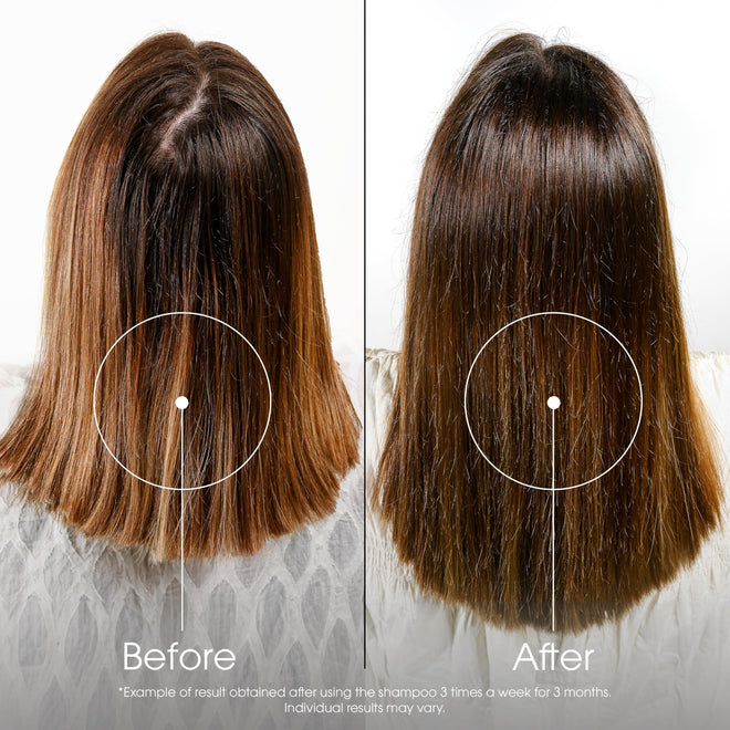 Klorane quinine fortifying shampoo for thin, tired hair, 400ml 🍁 All In One Marketplace Canada